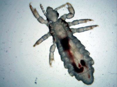 Удивительные фотографии под микроскопом 28 Апрель 2014 09:32 Удивительные фотографии под микроскопом 28 Апрель 2014 09:32