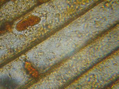 Удивительные фотографии под микроскопом 10 Июнь 2014 12:25 первое Удивительные фотографии под микроскопом 10 Июнь 2014 12:25 первое