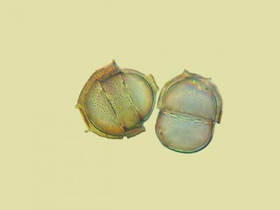 Удивительные фотографии под микроскопом 21 Октябрь 2014 13:02 второе Удивительные фотографии под микроскопом 21 Октябрь 2014 13:02 второе