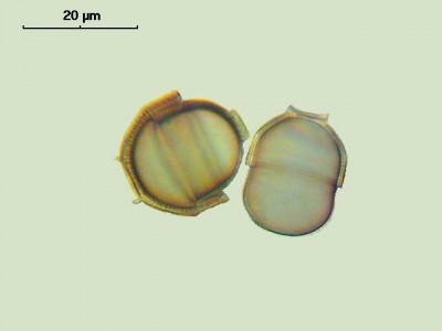 Удивительные фотографии под микроскопом 21 Октябрь 2014 13:02 первое Удивительные фотографии под микроскопом 21 Октябрь 2014 13:02 первое
