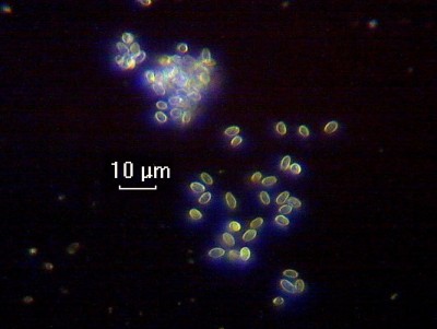 Как приготовить постоянный микропрепарат? 30 Октябрь 2014 22:06 Как приготовить постоянный микропрепарат? 30 Октябрь 2014 22:06