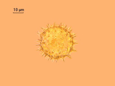 Удивительные фотографии под микроскопом 03 Ноябрь 2014 23:47 второе Удивительные фотографии под микроскопом 03 Ноябрь 2014 23:47 второе