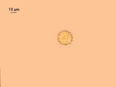 Удивительные фотографии под микроскопом 03 Ноябрь 2014 23:47 первое Удивительные фотографии под микроскопом 03 Ноябрь 2014 23:47 первое