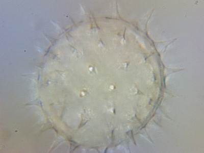 Стекинг в микрофотографии 08 Ноябрь 2014 20:46 четвертое Стекинг в микрофотографии 08 Ноябрь 2014 20:46 четвертое