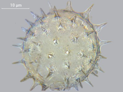 Стекинг в микрофотографии 08 Ноябрь 2014 20:46 третье Стекинг в микрофотографии 08 Ноябрь 2014 20:46 третье