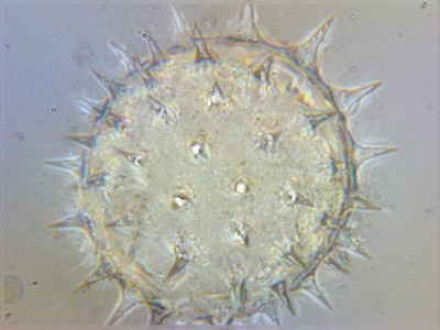 Стекинг в микрофотографии 08 Ноябрь 2014 20:46 второе Стекинг в микрофотографии 08 Ноябрь 2014 20:46 второе