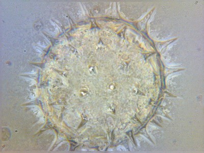 Стекинг в микрофотографии 08 Ноябрь 2014 20:46 первое Стекинг в микрофотографии 08 Ноябрь 2014 20:46 первое