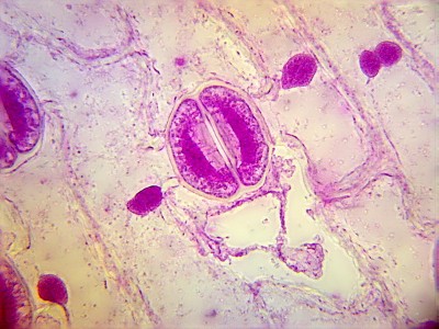 Удивительные фотографии под микроскопом 08 Ноябрь 2014 20:47 Удивительные фотографии под микроскопом 08 Ноябрь 2014 20:47