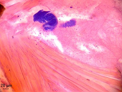 Удивительные фотографии под микроскопом 11 Ноябрь 2014 23:32 третье Удивительные фотографии под микроскопом 11 Ноябрь 2014 23:32 третье