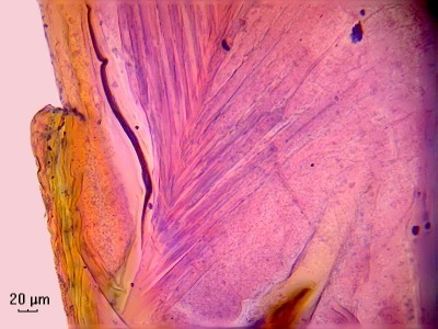 Удивительные фотографии под микроскопом 11 Ноябрь 2014 23:32 второе Удивительные фотографии под микроскопом 11 Ноябрь 2014 23:32 второе