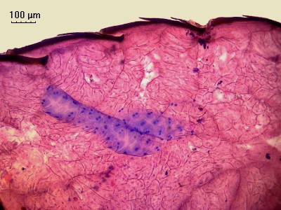 Удивительные фотографии под микроскопом 11 Ноябрь 2014 23:32 первое Удивительные фотографии под микроскопом 11 Ноябрь 2014 23:32 первое