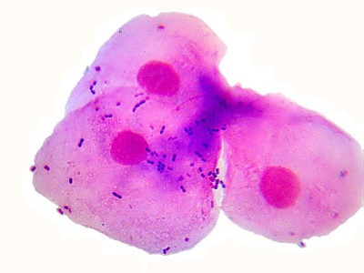 Удивительные фотографии под микроскопом 13 Ноябрь 2014 18:08 второе Удивительные фотографии под микроскопом 13 Ноябрь 2014 18:08 второе