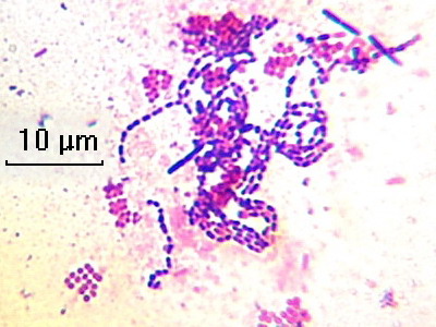 Удивительные фотографии под микроскопом 13 Ноябрь 2014 18:08 первое Удивительные фотографии под микроскопом 13 Ноябрь 2014 18:08 первое