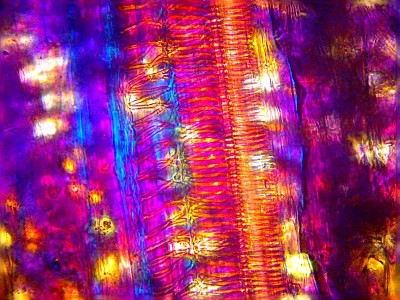 Удивительные фотографии под микроскопом 14 Ноябрь 2014 19:13 четвертое Удивительные фотографии под микроскопом 14 Ноябрь 2014 19:13 четвертое