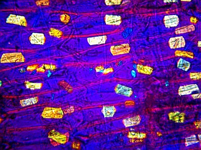 Удивительные фотографии под микроскопом 14 Ноябрь 2014 19:13 третье Удивительные фотографии под микроскопом 14 Ноябрь 2014 19:13 третье