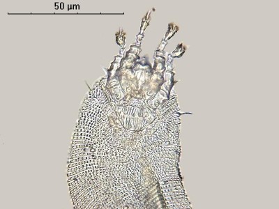Удивительные фотографии под микроскопом 22 Ноябрь 2014 20:25 Удивительные фотографии под микроскопом 22 Ноябрь 2014 20:25