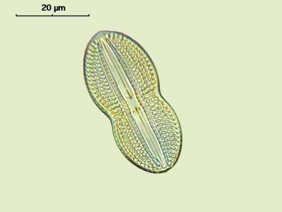 Удивительные фотографии под микроскопом 07 Декабрь 2014 11:42 четвертое Удивительные фотографии под микроскопом 07 Декабрь 2014 11:42 четвертое