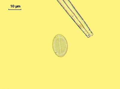 Удивительные фотографии под микроскопом 07 Декабрь 2014 11:42 третье Удивительные фотографии под микроскопом 07 Декабрь 2014 11:42 третье