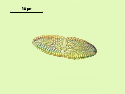 Удивительные фотографии под микроскопом 07 Декабрь 2014 11:42 первое Удивительные фотографии под микроскопом 07 Декабрь 2014 11:42 первое