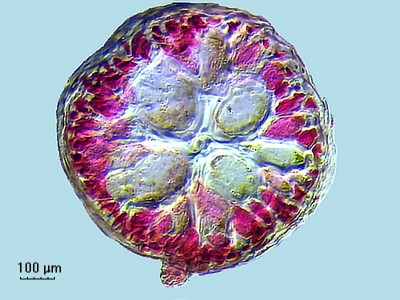 Удивительные фотографии под микроскопом 25 Декабрь 2014 21:10 третье Удивительные фотографии под микроскопом 25 Декабрь 2014 21:10 третье