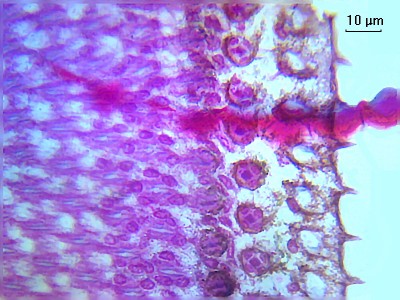 Удивительные фотографии под микроскопом 05 Январь 2015 01:42 третье Удивительные фотографии под микроскопом 05 Январь 2015 01:42 третье