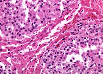 Удивительные фотографии под микроскопом 16 Август 2013 15:22 третье Удивительные фотографии под микроскопом 16 Август 2013 15:22 третье