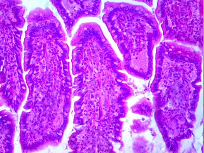Удивительные фотографии под микроскопом 19 Август 2013 10:57 второе Удивительные фотографии под микроскопом 19 Август 2013 10:57 второе
