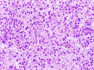 Удивительные фотографии под микроскопом 19 Август 2013 10:57 первое Удивительные фотографии под микроскопом 19 Август 2013 10:57 первое